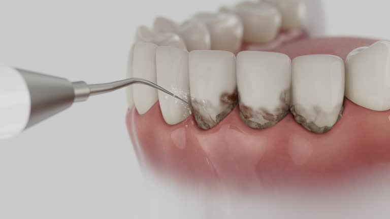 Trusted Tooth Extraction service in Farmersville, OH - Dentist Open Now